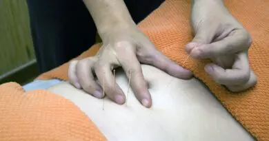 akupunktur hand