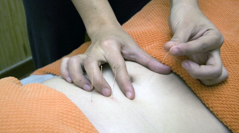 akupunktur hand