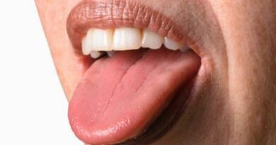 Nährstoffmangel auf der Zunge erkennen