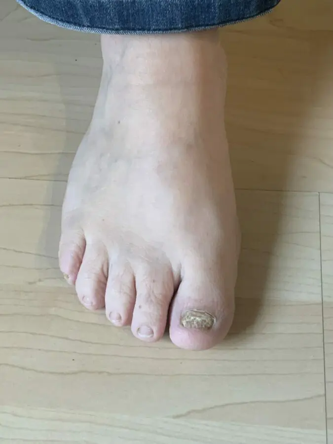 nagelpil4 scaled