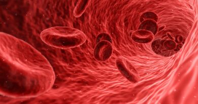 Demenz und Cholesterin