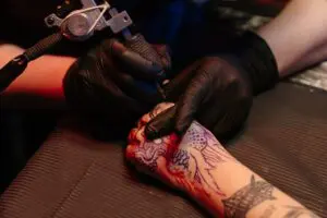 Tattooentfernung